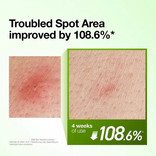 AZELAIC ACID 10 HYALURON REDNESS SOOTHING SERUM